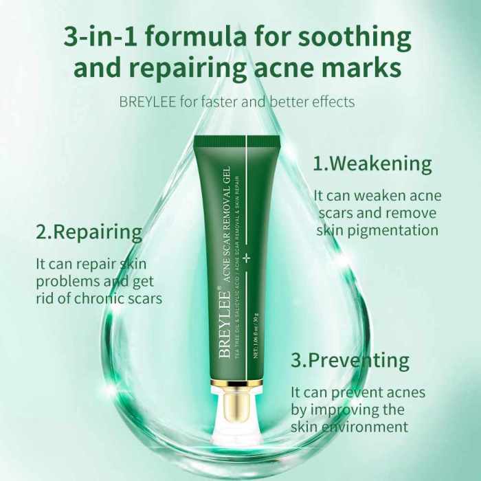 cream acne scar removal face skin treatment care remove repair 30g marks stretch whitening