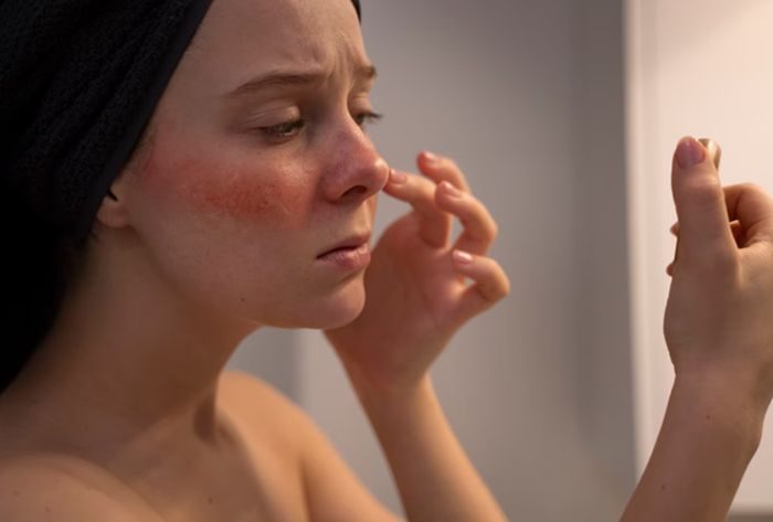 Ilustrasi kulit tipis/Freepik: freepik