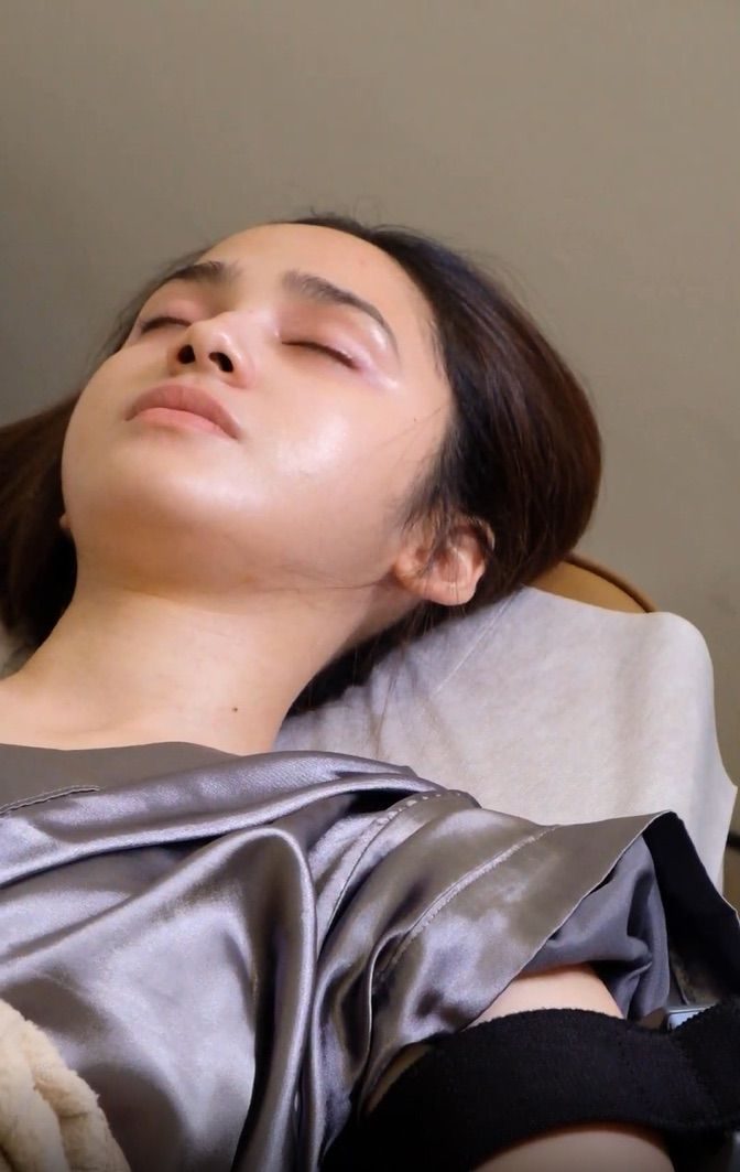 Rangkaian perawatan Pre-Wedding Syifa Hadju di Dermalogia