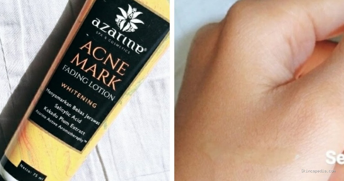 Azarine Acne Mark Fading Lotion: Kenali Ingredients Whiteningnya