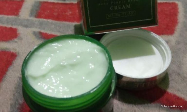 Breylee Acne Treatment Cream: Cek Ingredients & Manfaatnya