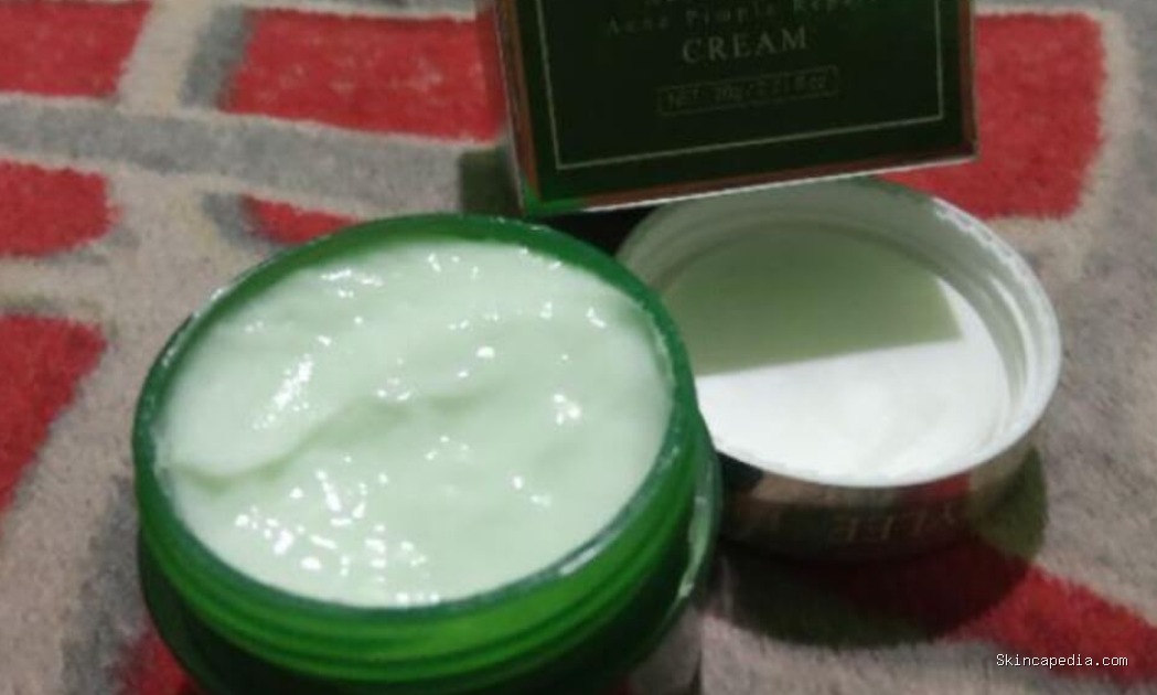Breylee Acne Treatment Cream: Cek Ingredients & Manfaatnya