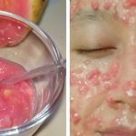 Cara Membuat Masker Jambu Biji Alami untuk Wajah Cerah