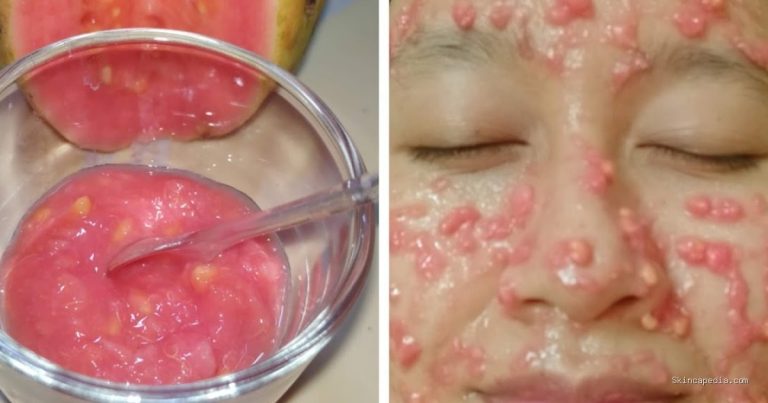 Cara Membuat Masker Jambu Biji Alami untuk Wajah Cerah