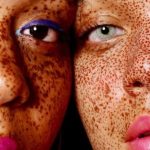 Flek Hitam Hilang: Mitos atau Fakta? Ini Penjelasannya