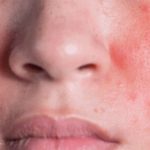 Rekomendasi Moisturizer Terbaik untuk Skin Barrier Anda: Rahasia Kulit Sehat