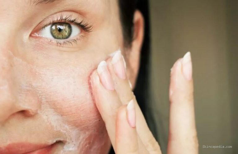 Rekomendasi Pembersih Wajah untuk Kukit Oily-Acne Prone Skin