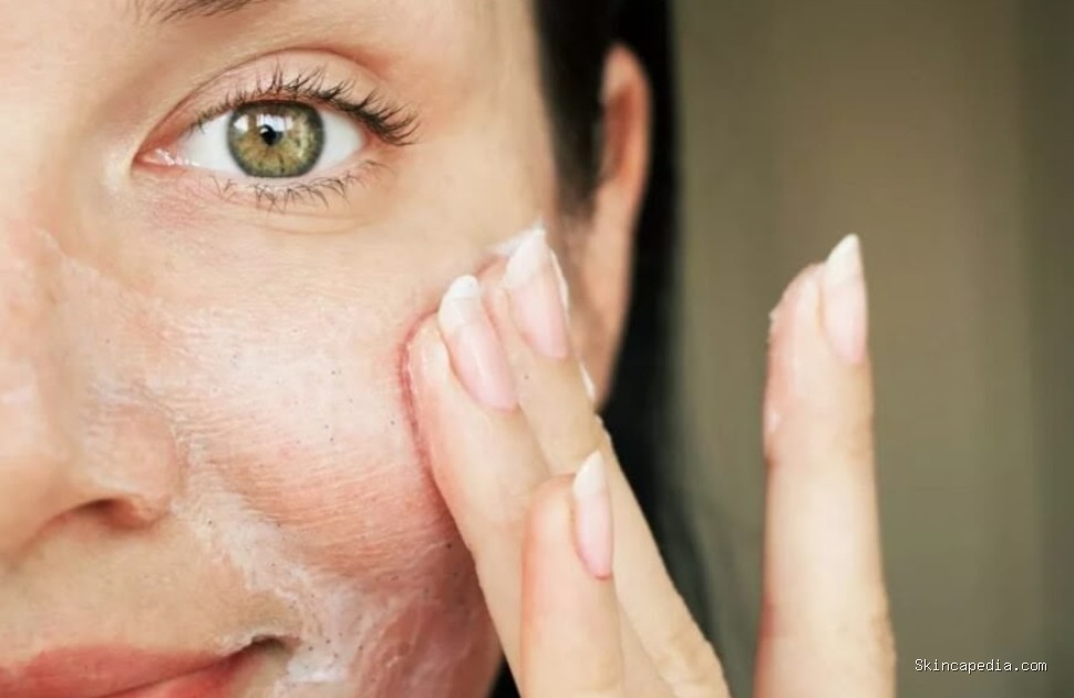 Rekomendasi Pembersih Wajah untuk Kukit Oily-Acne Prone Skin
