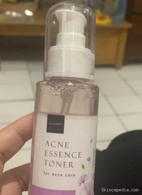 Scarlett Acne Essence Toner: Cek Ingredients & Manfaatnya