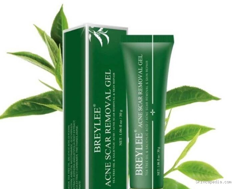 Breylee Acne Scar Removal Gel: Cek Kandungan & Efektivitasnya