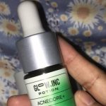 Glowinc Potion Acnecore: Ingredients Ampuh Atasi Jerawatmu