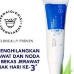Review Jujur ERHA Acneact Acne Spot Gel: Ampuh Basmi Jerawat?