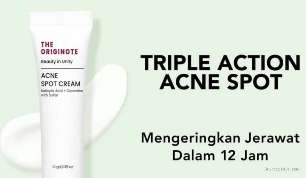 The Originote Acne Spot Cream: Solusi Ampuh Jerawat!
