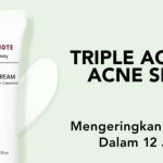 The Originote Acne Spot Cream: Solusi Ampuh Jerawat!
