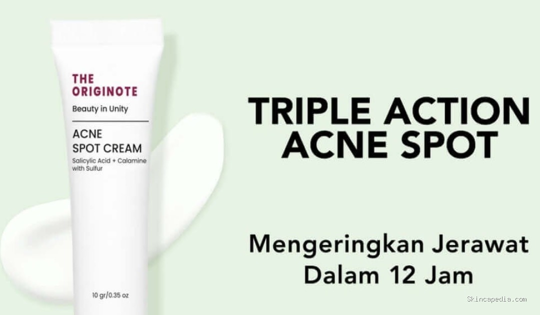 The Originote Acne Spot Cream: Solusi Ampuh Jerawat!