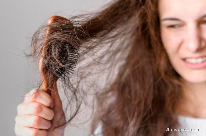 Rambut rontok berlebih disebabkan oleh kekurangan zat besi. Kesehatan rambut bergantung pada zat besi dan nutrisi lainnya/Foto: freepik.com/freepik