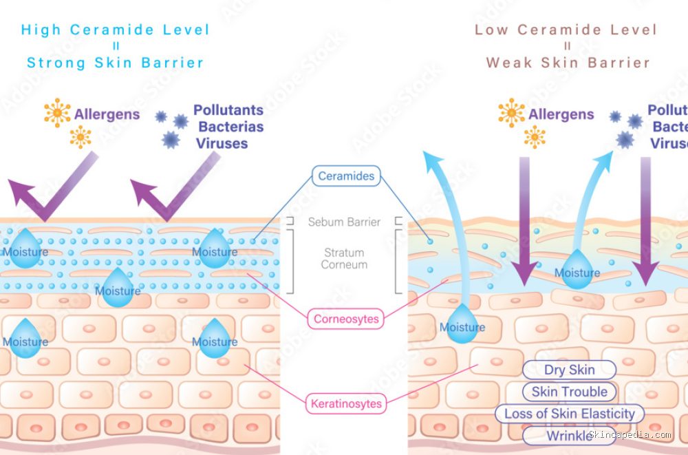 Photo by stock.adobe.com - Manfaat Ceramide untuk Memperbaiki Skin Barrier yang Rusak