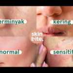 Photo via Bing Images - Panduan Mengatasi Kulit Wajah Sensitif dengan Tepat dan Aman