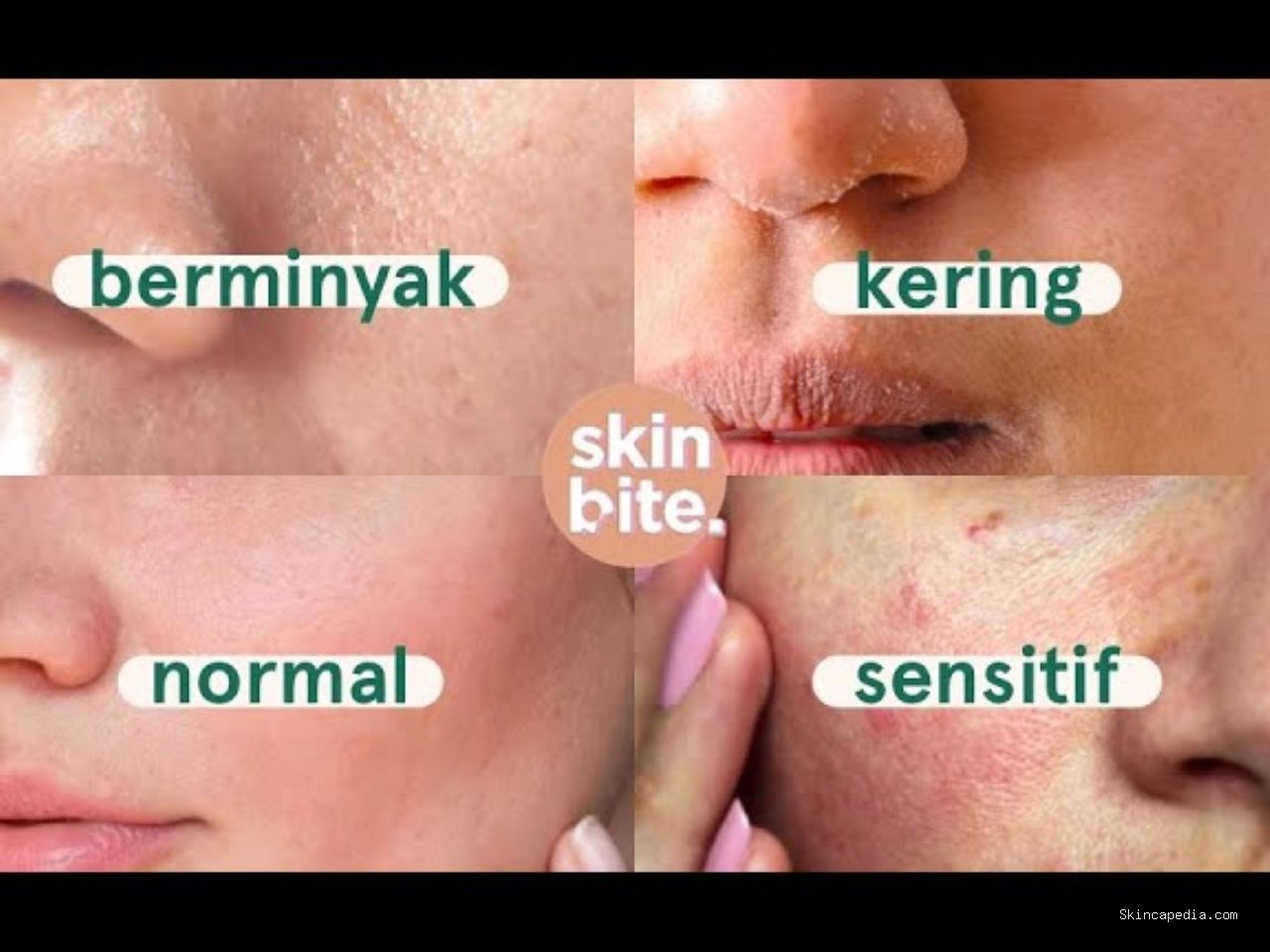 Photo via Bing Images - Panduan Mengatasi Kulit Wajah Sensitif dengan Tepat dan Aman
