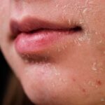 Photo via Bing Images - Penyebab Wajah Mengelupas Meski Sudah Rutin Pakai Moisturizer