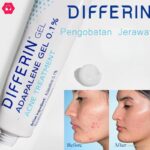 Photo by shopee.co.id - Efek Menggabungkan Benzoyl Peroxide dan Retinol Pada Jerawat Meradang