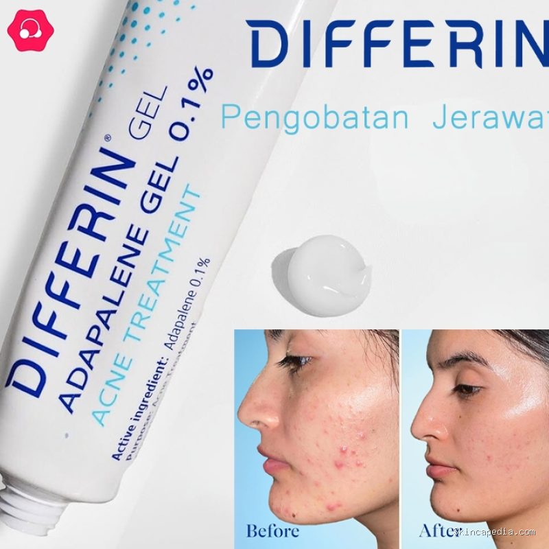 Photo by shopee.co.id - Efek Menggabungkan Benzoyl Peroxide dan Retinol Pada Jerawat Meradang