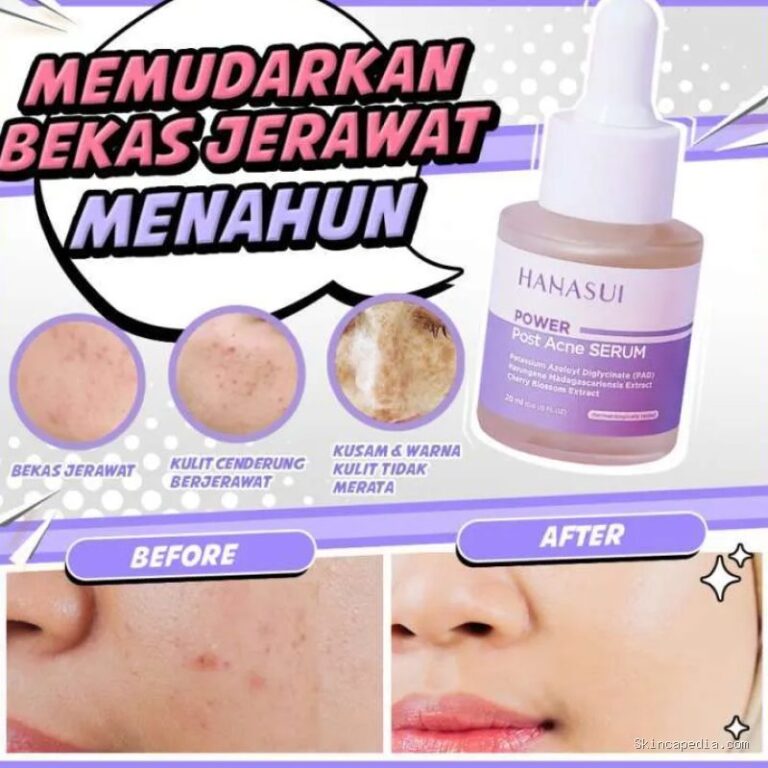 Photo by blibli.com - Kandungan Serum yang Efektif Menghilangkan Bekas Jerawat