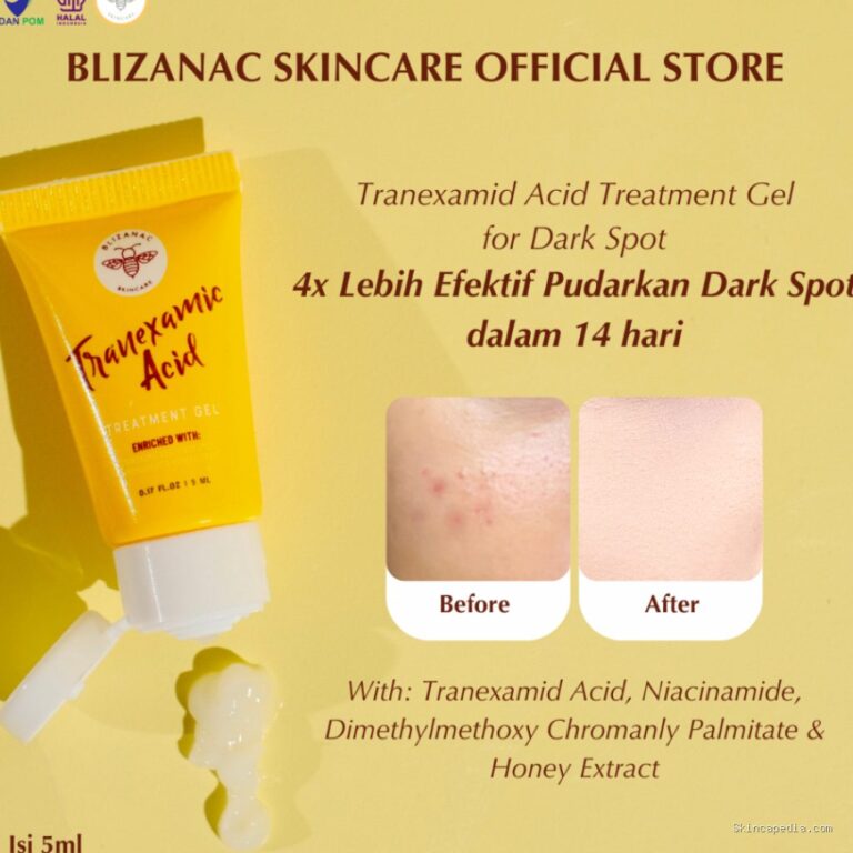 Photo by shopee.co.id - Panduan Memilih Kandungan Skincare untuk Mengatasi Flek Hitam