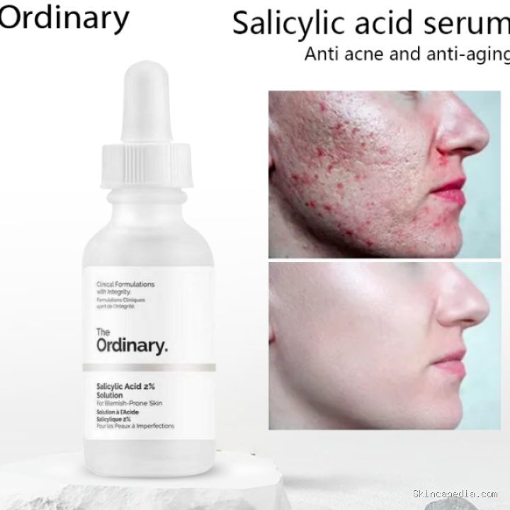 Photo by lazada.com.ph - Panduan Menggunakan Salicylic Acid Tanpa Membuat Kulit Kering
