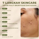 Photo by blog.avoskinbeauty.com - Penyebab Bruntusan di Jidat dan Rekomendasi Skincare yang Tepat