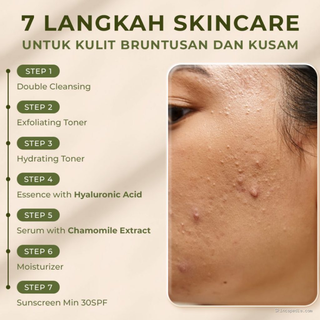 Photo by blog.avoskinbeauty.com - Penyebab Bruntusan di Jidat dan Rekomendasi Skincare yang Tepat