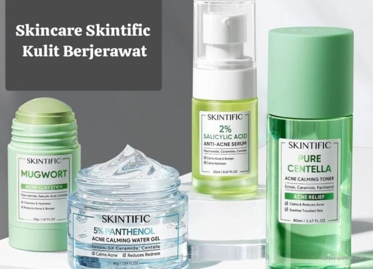 Photo by sumeks.disway.id - Perbedaan Jerawat Purging dan Breakout Akibat Skincare Baru